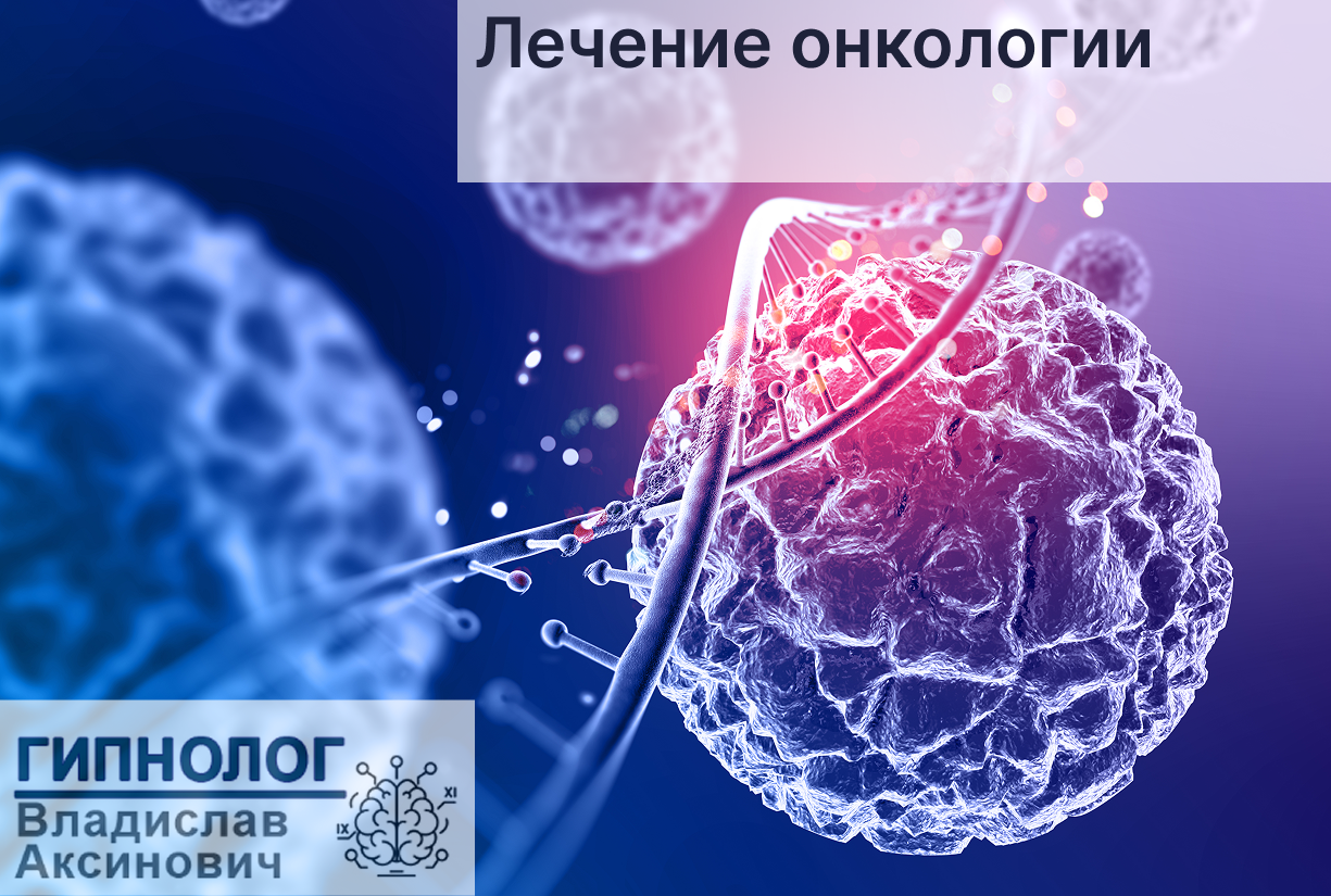 ЛЕЧЕНИЕ ОНКОЛОГИИ ГИПНОЗОМ
